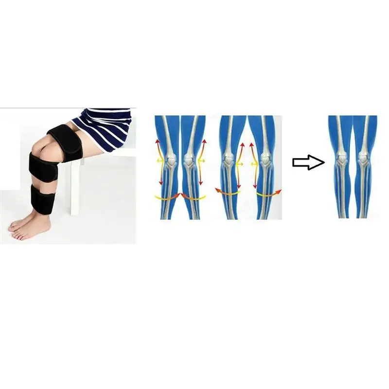 1 шт. Пояс для коррекции ног X Пояс для выпрямления ног Prime O Legs для дома