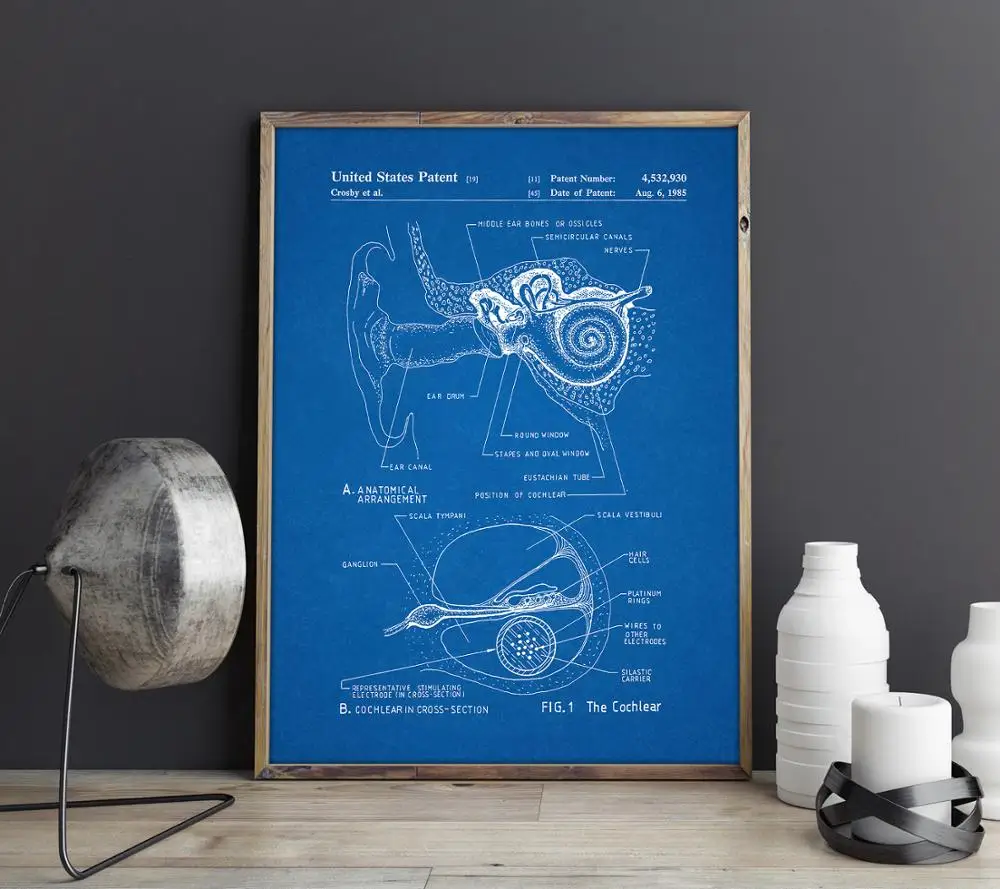 Cochlear Implant патент печати, ухо анатомический плакат, внутренний ушной диаграмма, аудиолога искусства, ЛОР подарок для врача, слуховой аппарат Декор