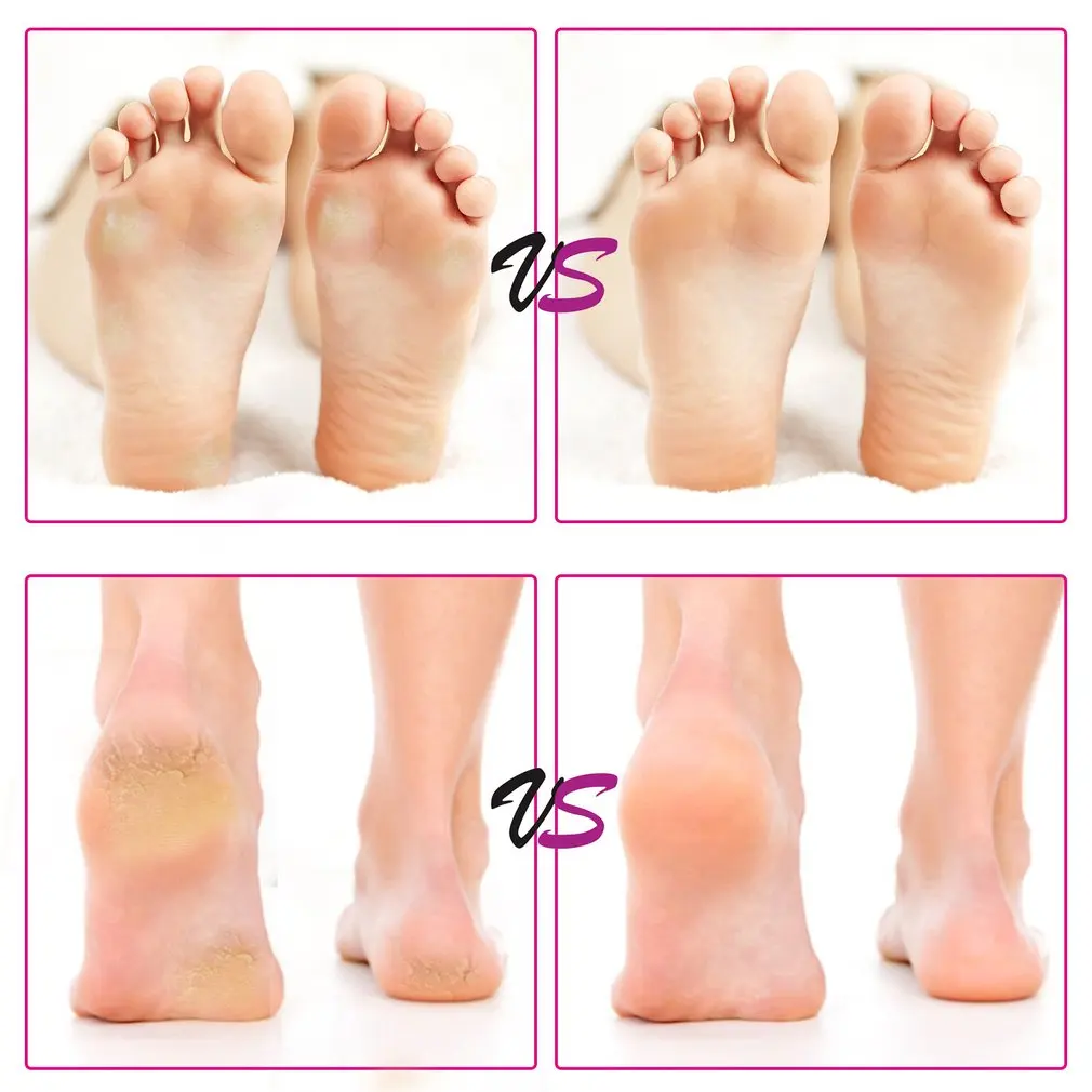 Removedor de Calos do pé Máquina de Velocidade Cuidados com os Pés Mortas da Pele Removedor de Casca Elétrico Pedicure Ajustável Ferramenta Pés 12 Cheap Instrumento cuidados c pés