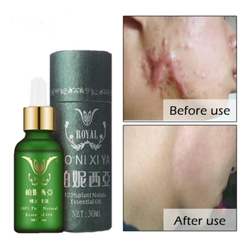 

30ml Repairing Essential Oil Acne Scar Spots Removal Skin Repair Face Care Skin Care Pure Natural Oil -