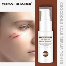 Яркие гламурные с изображением крокодила и уход за кожей лица Тонер ремонт шрам Сыворотки для удаления рубцов от акне Знаки уменьшает поры ярче сбросить чувствительную кожу