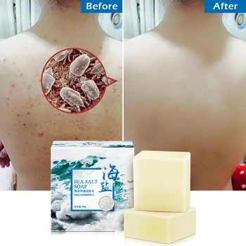 

Hot ! 100g Removal Pimple Pore Acne Treatment Sea Salt Soap Cleaner Moisturizing Goat Milk Soap Face Care Wash Basis Soap TSLM1