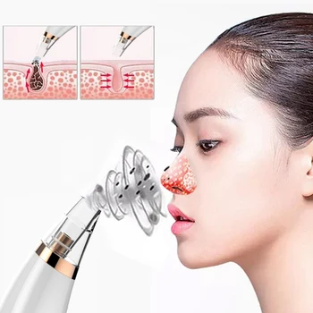 

New 6 Probes Effective Blackhead Remover Electric Facial Pore Cleaner Vacuum Conduction Super Suction