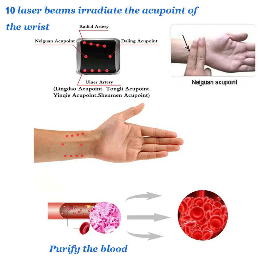 LLLT холодная лазерная терапия часы устройство для тиннита отита ринит фарингит облегчение боли кровообращение