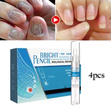 Грибковая ручка для лечения Ногтей Onychomycosis Paronychia анти-инфекция жидкий ремонт ногтей кисть масло для кутикулы# Zer