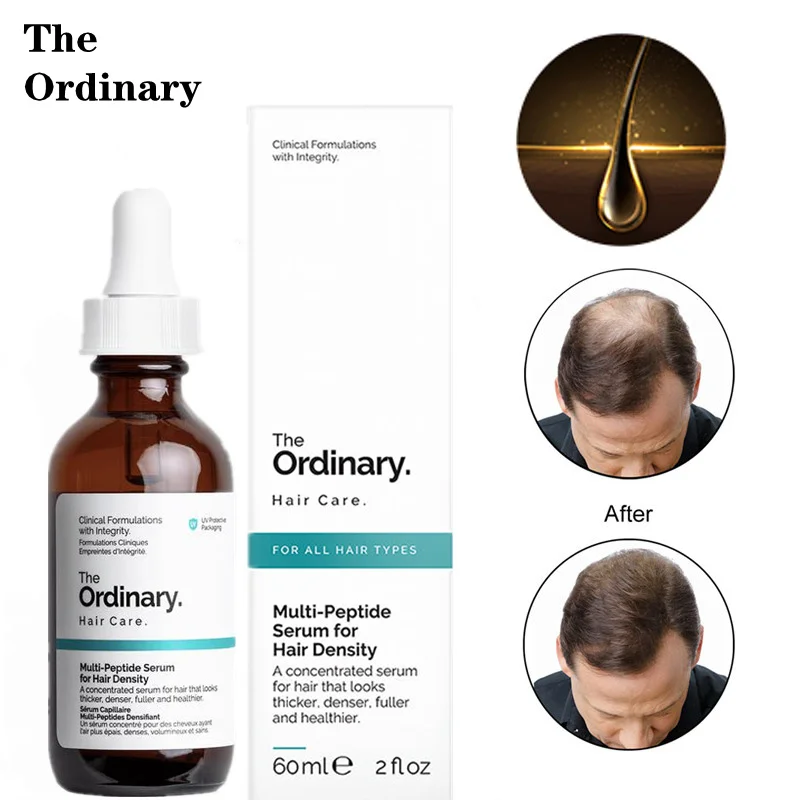 Оригинальные аутентичные эфирные масла для роста волос The Ordinary уход за эссенцией