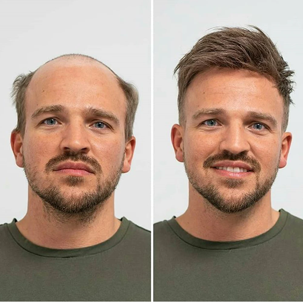 toupee111