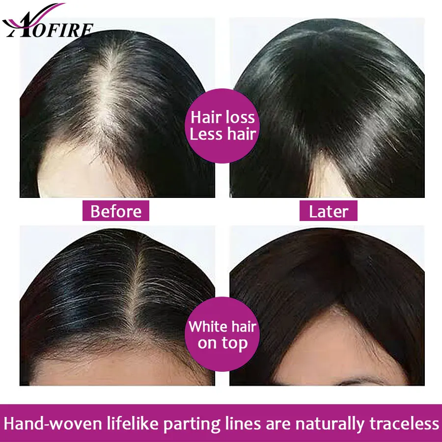 头皮对比2 - 副本