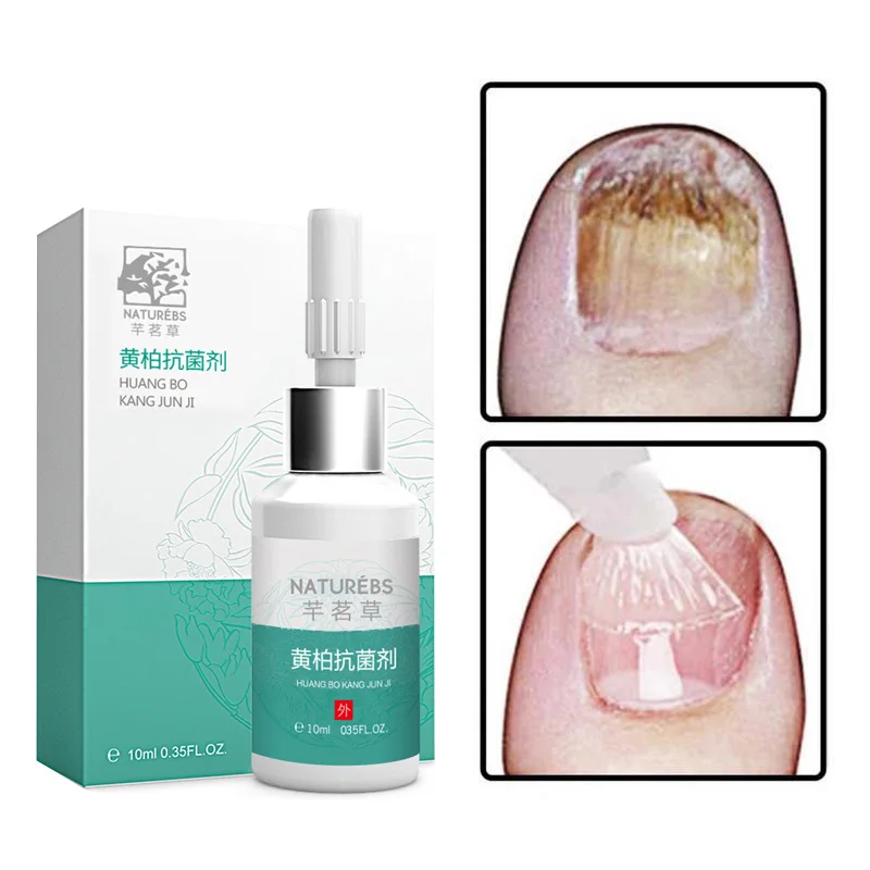 

WXE Cocoon Clear Biofilm Powerful Removel Foot Hands Corn Cocoon Useful Foot Callus Remover Liquid 10ml