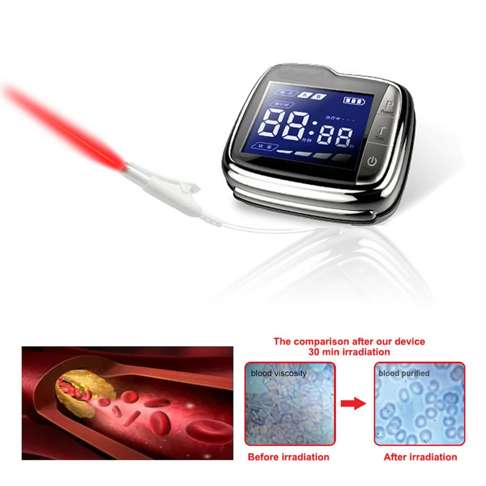 

650nm Laser Therapy Wrist Low Frequency Hypertension Hyperlipidemia Hyperviscosity Cholesterol Treatment Laser Therapy Watch