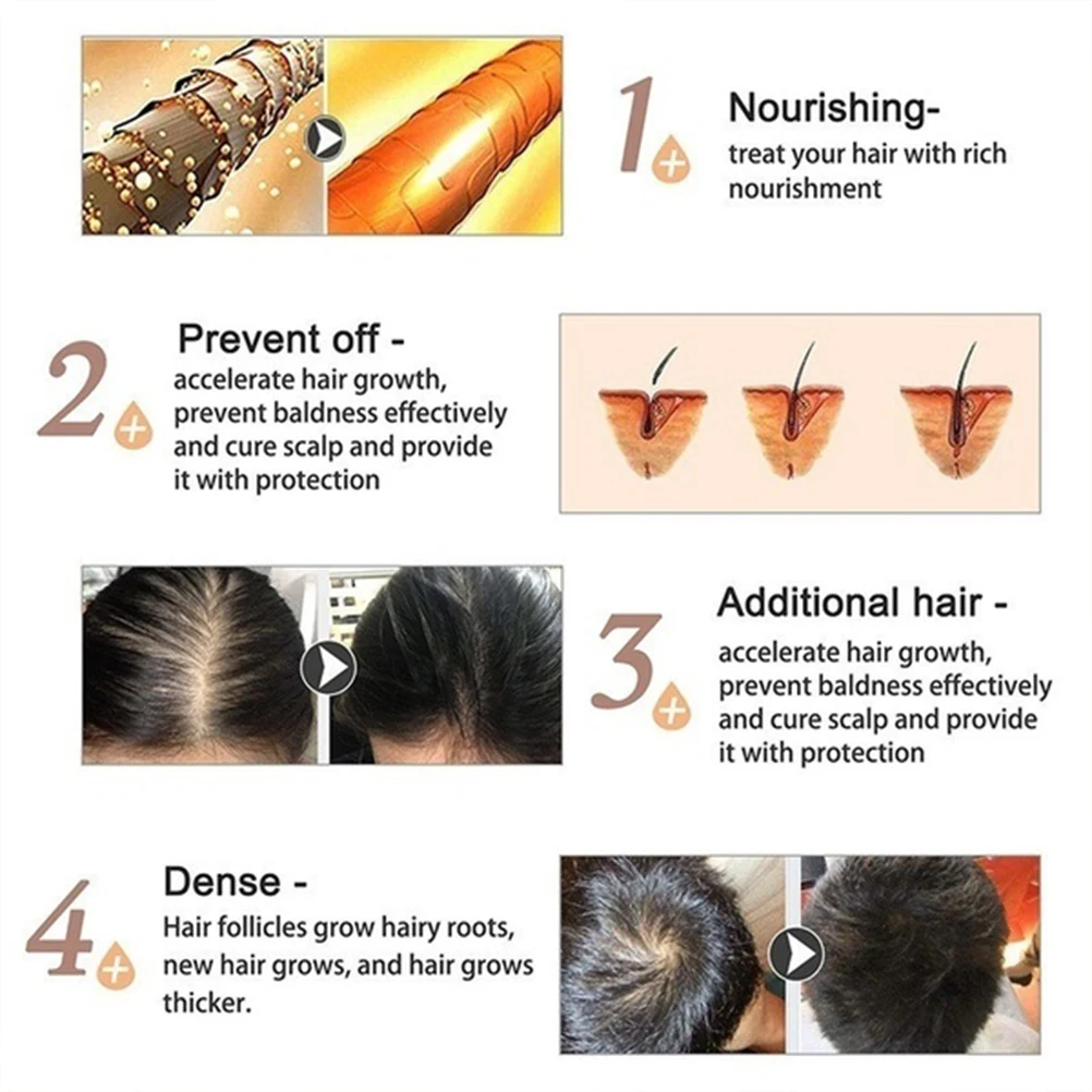 20 мл эфирное масло для роста волос эффективное для предотвращения выпадения волос естественный здоровый рост волос уход за волосами растительный питательный раствор