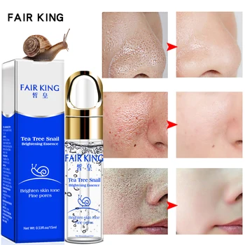 

Tea Tree Hyaluronic acid Snail Plant Extract Face Serum Whitening Blemish Serum Ampoules Anti-acne Rejuvenation Facial Liquid