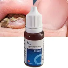 Здоровье, Уход за ногтями, Лечение грибка ногтей, дезинфицирующее жидкое моющее средство, средство для удаления онихомикоза, сыворотка для красоты, дезинфицирующая вода, 10 мл