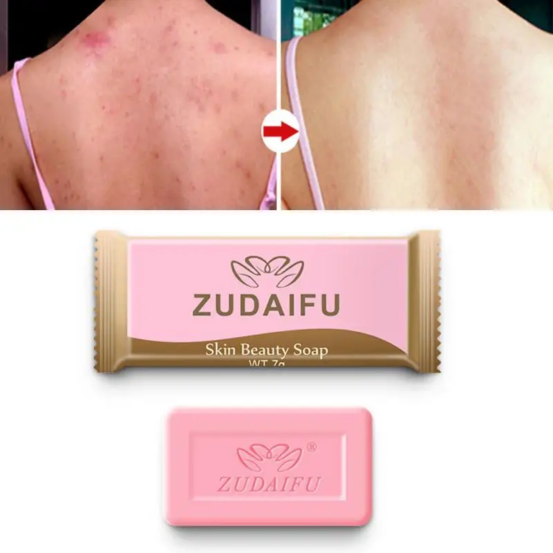 Sulfur Soap Oil-Control Acne Treatment lackhead Remover Soap 85g Whitening Cleanser Chinese Traditional Skin Care