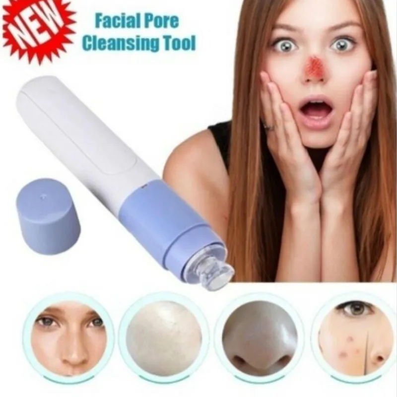 Mini Electric Facial Pore Blackhead Removers Skin Care Tool Cleanser Vacuum Face Dirt Suck Up Acne 1 Mini Electric Facial Pore Blackhead Removers Skin Care Tool Cleanser Vacuum Face Dirt Suck Up Acne 2