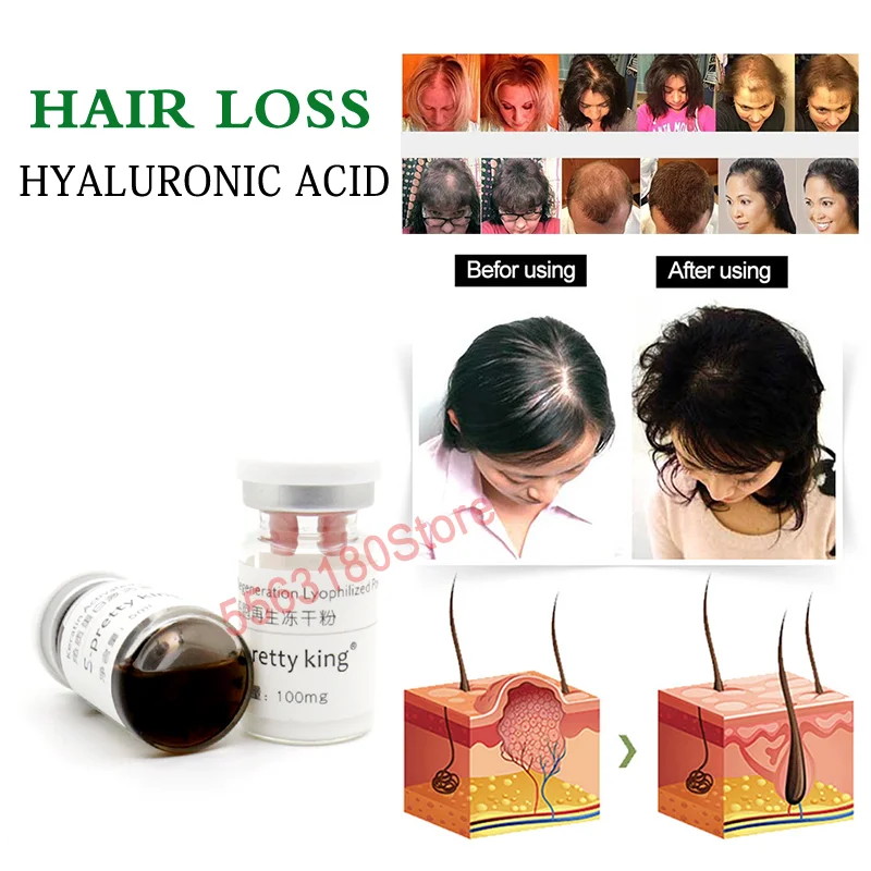 

Hair Growth Hyaluronic Acid Keratin Liquid Thickening Hair Growing Liquid For Hyaluron Pen Microneedling Treatment Hair Loss