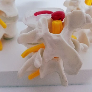 

New Human Anatomy Skeleton Spine 4-Stages Lumbar Vertebral Model Brain Skull Traumatic Teaching Supplies