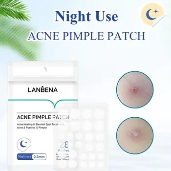 

25/28 Fast Remover Pimple Master Patch Treatment Acne Patch Skin Tags Protects Wounded Or Troubled Areas Beauty Set Makeup Tools