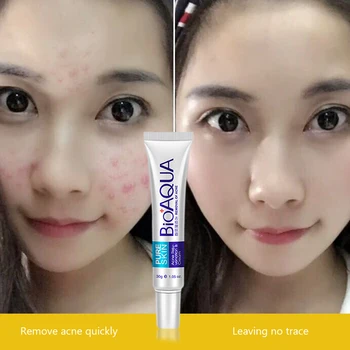 

BIOAQUA Natural Aloe Vera Smooth Gel Acne Treatment Face Cream for Hydrating Moist Repair After Sun Free Shipping