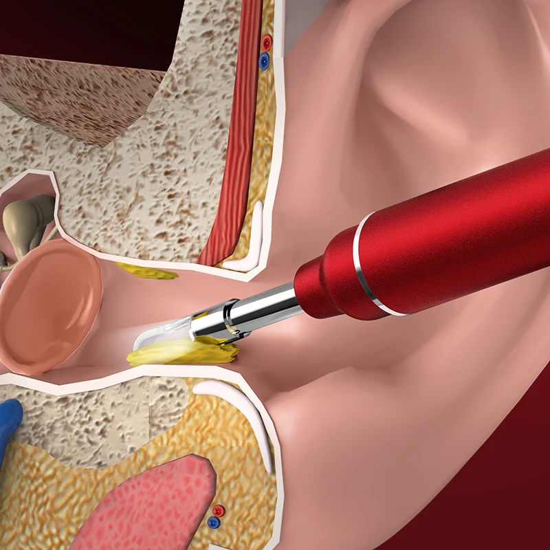 HD 3.9mm Digital Otoscope Video WiFi Earpick Camera Ear Scope Camera Visual Ear Cleaning Endoscope for iOSAndroid smartphone