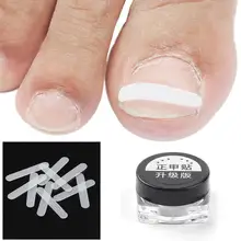 Коррекционный фиксатор проволоки для пальцев ног, отличный прочный пластик, нержавеющая сталь, лечение вросшего паранихиа, восстановление