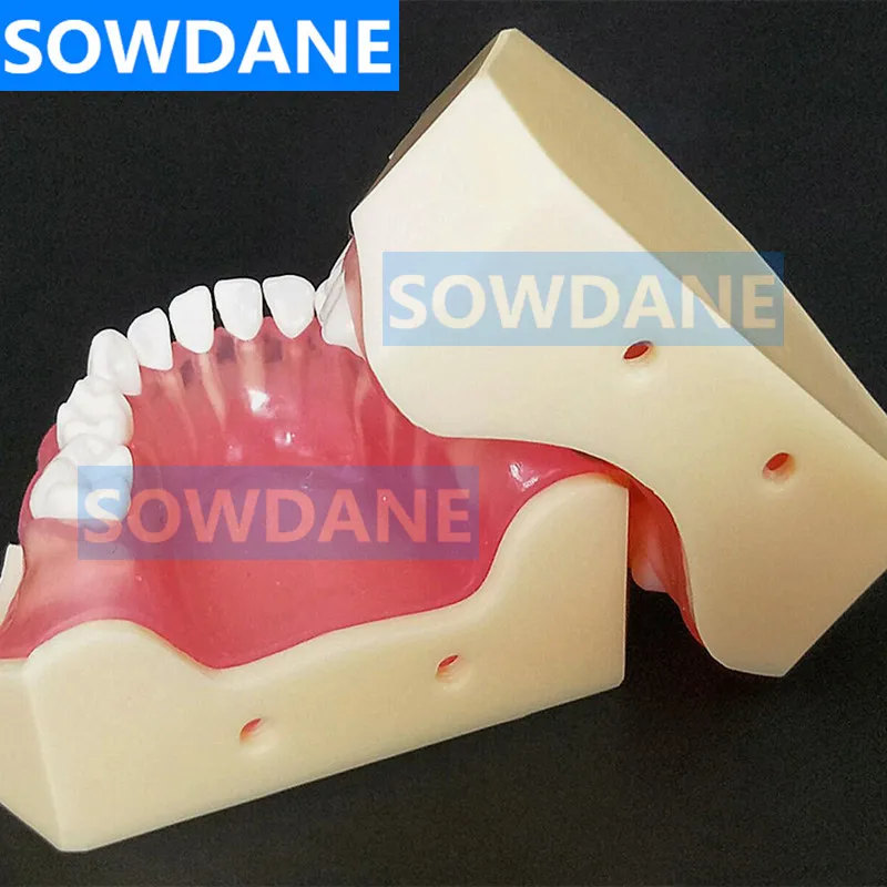  Dental 1:1 Study Teaching Model Dental Children Standard Model Removable Teeth Soft Gum Kid TYPODON - 4000170129781