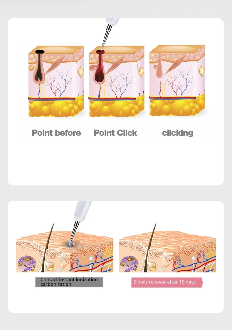 Новая мгновенная карбонизация удаление черных пятен веснушки плазменная ручка меланин удаление татуировки ручка уход за кожей лица косметическое устройство