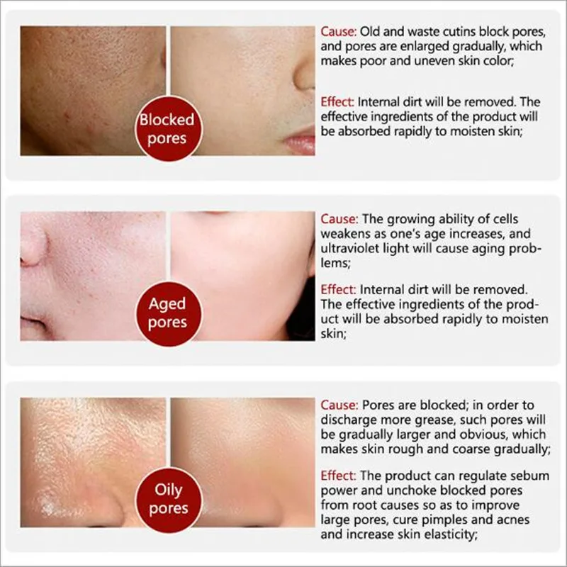 LANBENA Face Serum Shrink Pore Treatment Pore Serum Essence Relieve Dryness Oil Control Firming Moisturizing Repairing 5