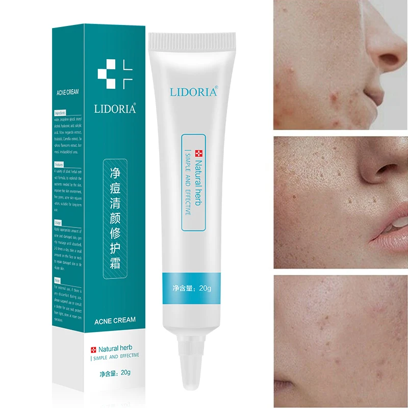 blemish treatment cream