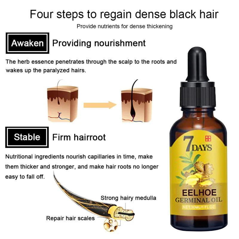Hair Growth Products Ginger Fast Growing Hair Essential Oil Beauty Hair Care Prevent Hair Loss Oil Scalp Treatment For Men Women
