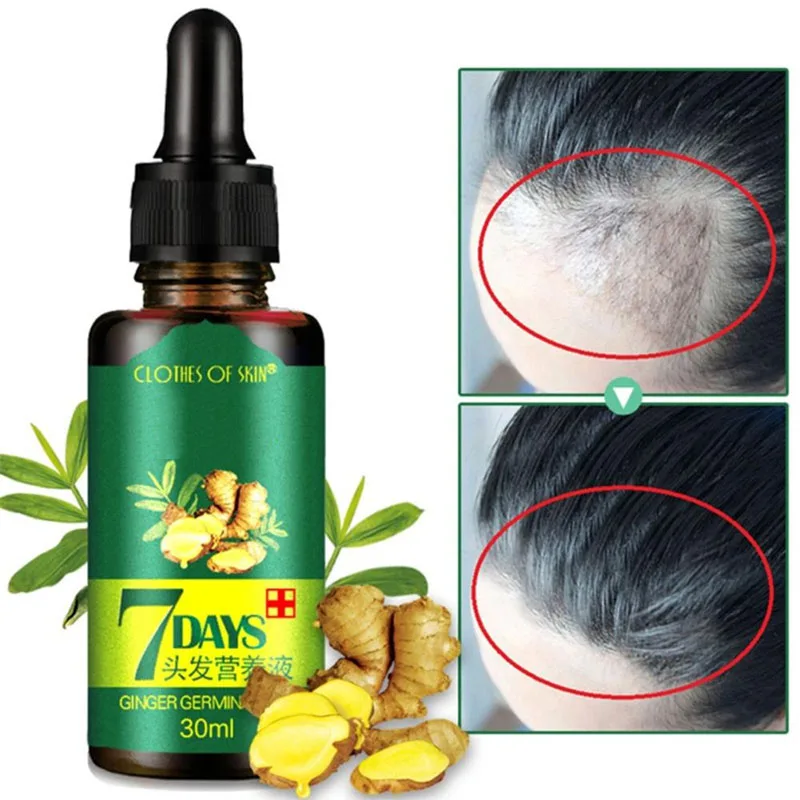 2/3/4 Uds 7 días el crecimiento del cabello aceite de jengibre 30ml líquido antipérdida de cabello dañado reparación crecer el pelo tratamiento esencia