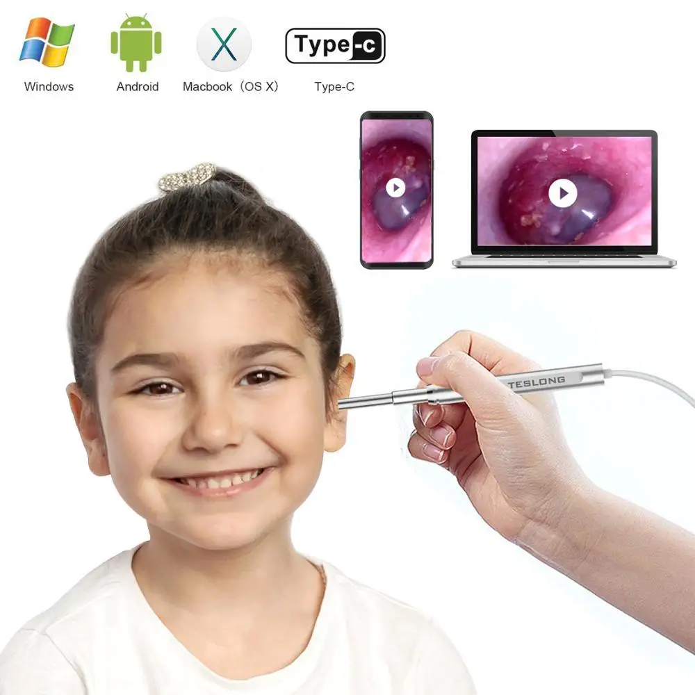 Камера Эндоскоп TESLONG для чистки ушей 720HD 6 светодиодов USB визуальная ухочистка 3 9