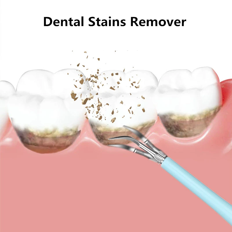 Электрический прибор для удаления зубного камня портативный звуковой стоматологический скалер usb зарядка удаление пятен зубов зубной камень отбеливание зубов Уход за полостью рта