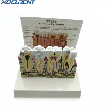 

1pcs Dental Teeth Anatomical Model Oversized Anatomy Models For Dentist Studying and Researching