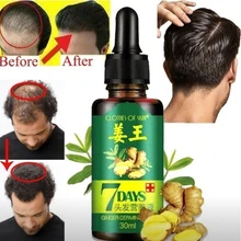 Сыворотка для роста волос, 7 дней, имбирь, герминовая сыворотка, сывороточная эссенция для предотвращения выпадения волос