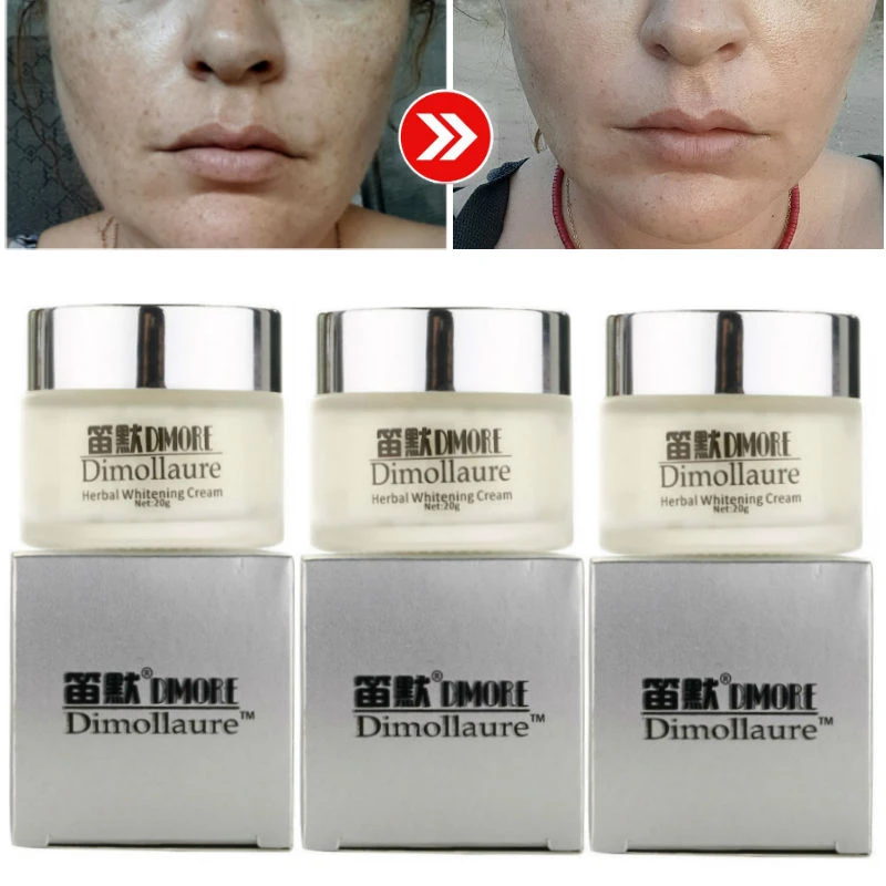 Dimollaure Herbal Whitening Freckle Cream Removal Melasma Pigment Melanin Pregnant Scar Dimore Face Cream Whitening Freckle Cream Freckles Creamface Cream Aliexpress
