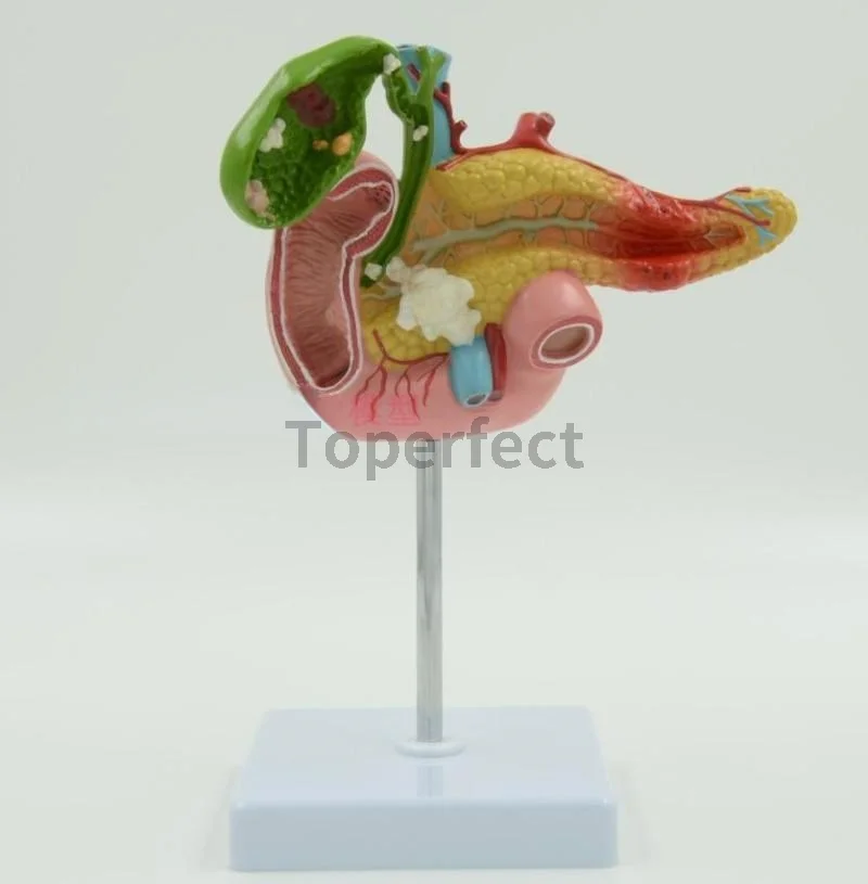 

1:1 life sized Pancreatic Duodenum and Gallbladder Pathological Anatomical Model Surgical Digestive System Model