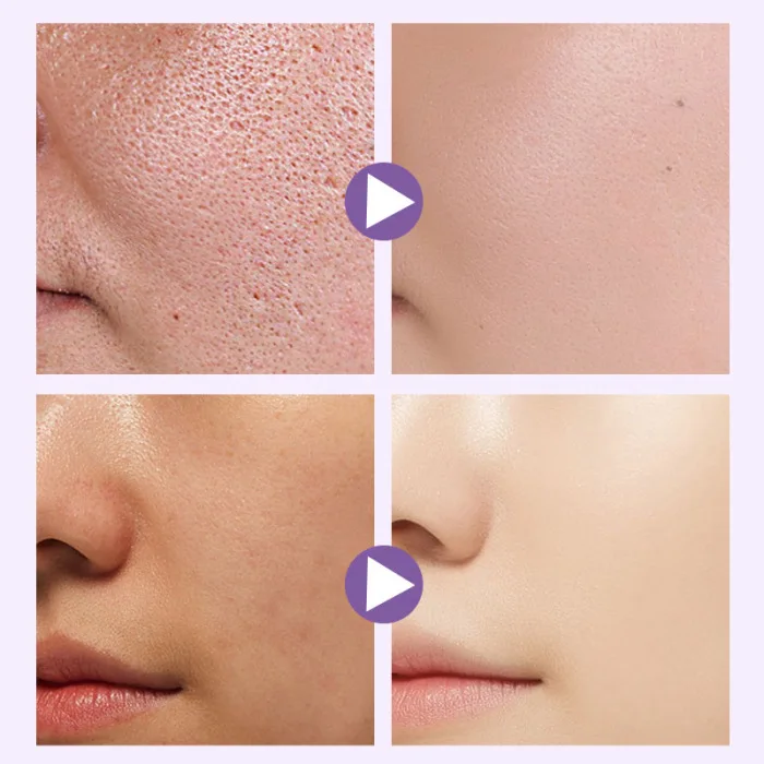 Niacinamide эссенция Осветляющий, увлажняющий отбеливающий эссенция для кожи EY669