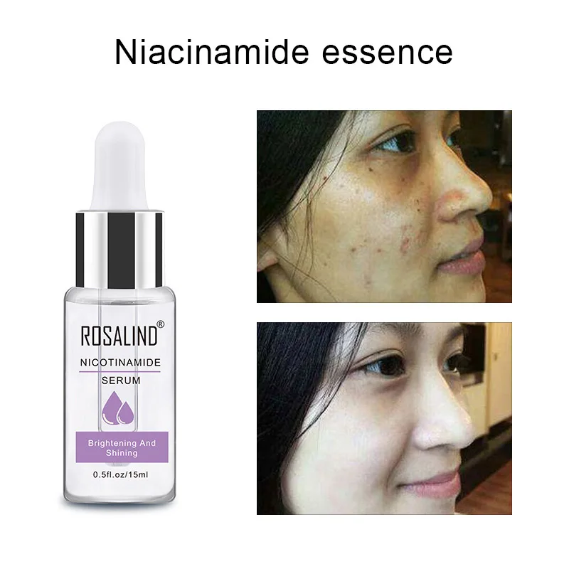 Абсолютно Niacinamide эссенция Осветляющий, увлажняющий отбеливающий эссенция для кожи LVS88