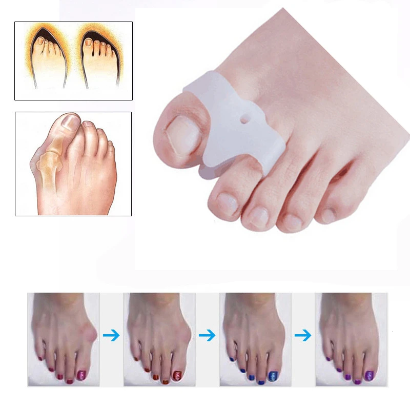 2pcs/pair Hallux Valgus Correction Pedicure Device Bunion Toe Separators Feet Care Thumb Orthotics Corrector Splint Protector
