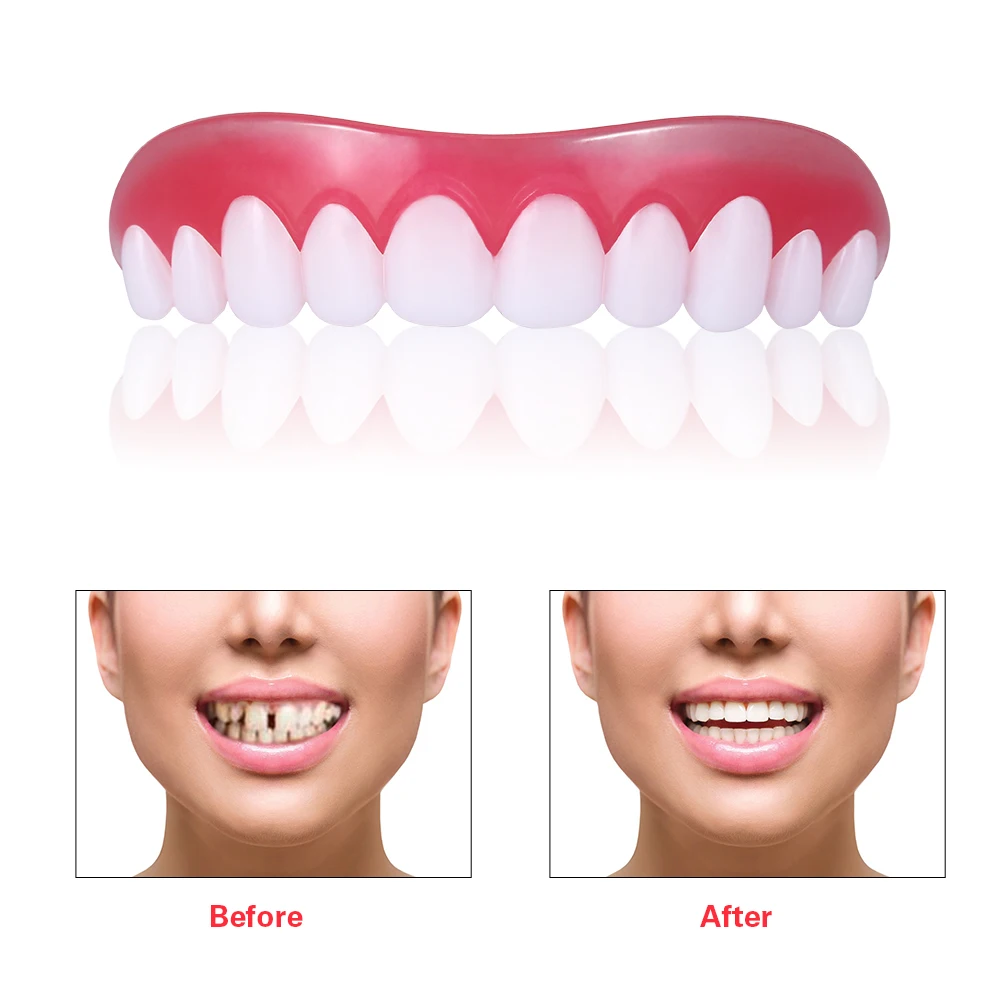 1 Pcs/Box Upper Dental Veneers Comfort Fit Flex Teeth Decoration Dentures Tooth Veneers Polyethylene Dentaduras Dentes Falsos