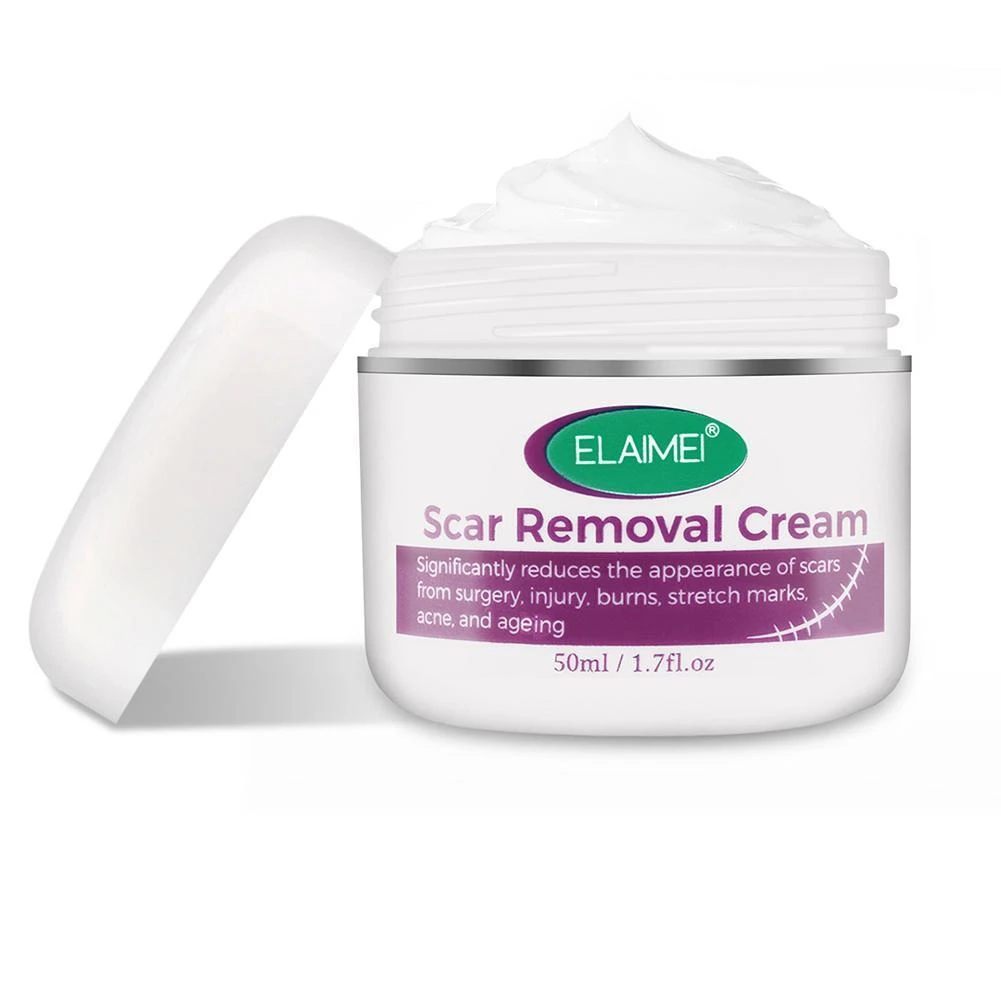 stretch marks removal cream