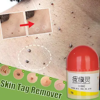 

1PCS Skin beauty cream Skin Tag Remover 12 hours Tu Remover Mole kill Tu Skin Medical kill Tag N0P9