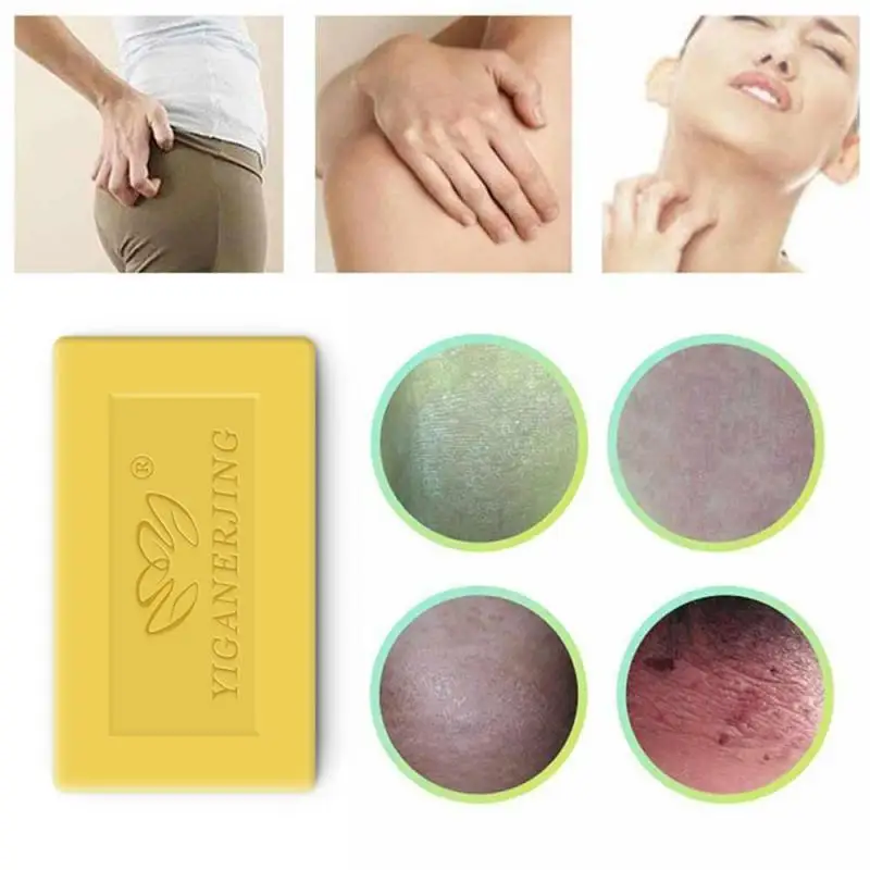 3pcs yiganerjingSulfur Soap making Skin whitening soap for Acne Psoriasis Seborrhea Eczema Anti Fungus Bath shampoo 3pcs yiganerjingSulfur Soap making Skin whitening soap for Acne Psoriasis Seborrhea Eczema Anti Fungus Bath shampoo