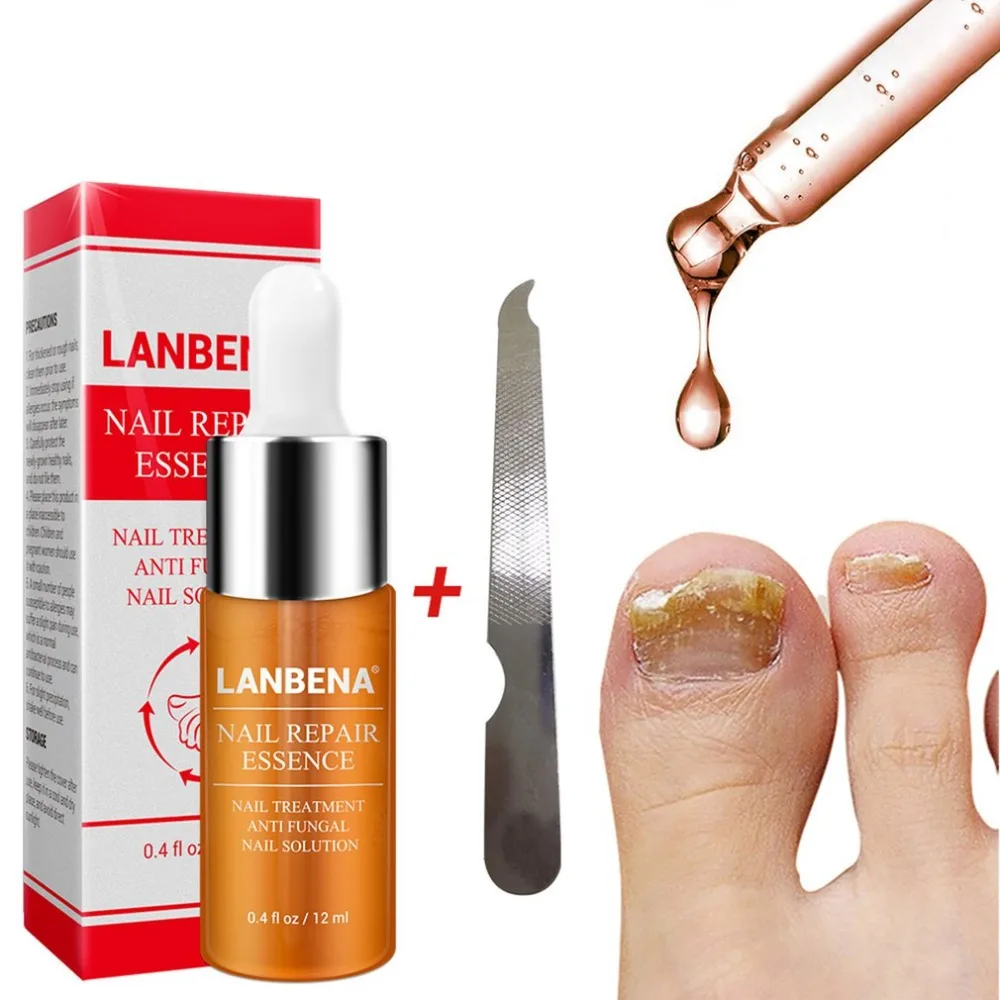 LANBENA, средство для восстановления ногтей, сыворотка, Лечение грибка, удаление ногтей, онихомикоз, ноготь, свечение, питательный уход за руками и ногами