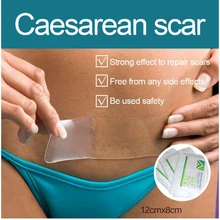 Медицинская лента