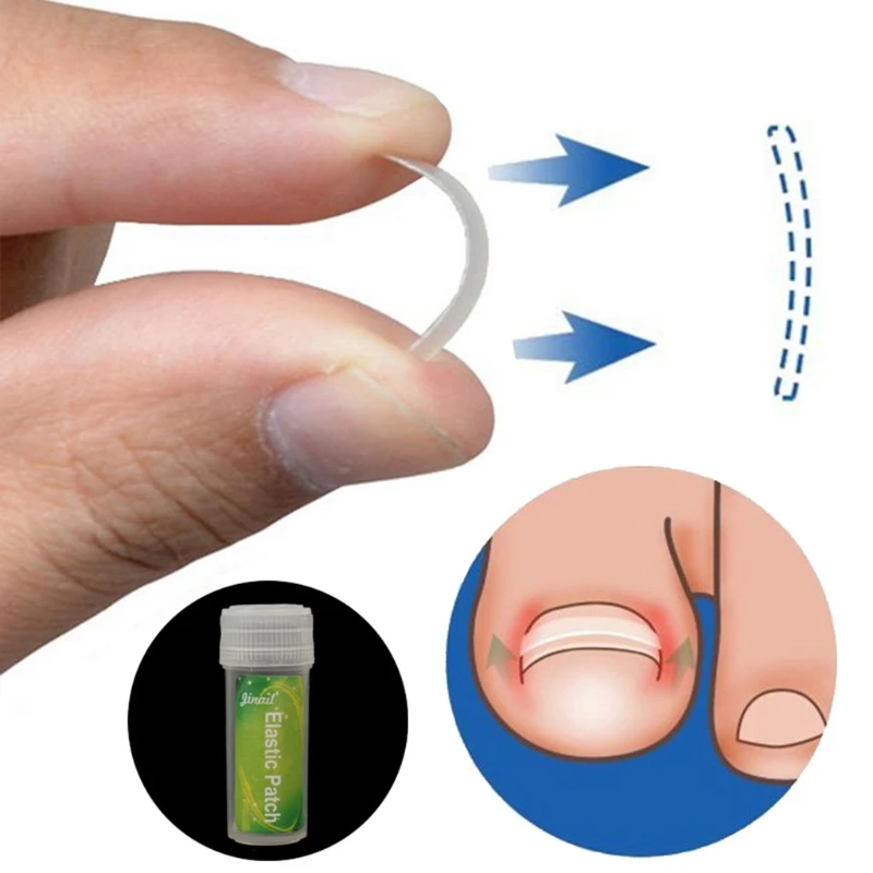 

5Pcs/Set Ingrown Toe Nail Correction Tool File Straightening Patch Foot Care Kit