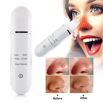 

Skin Scrubber Black Head Cleaner Blackhead Removal Equipment White USB Charging Positive and Negative Ions Fast Effective