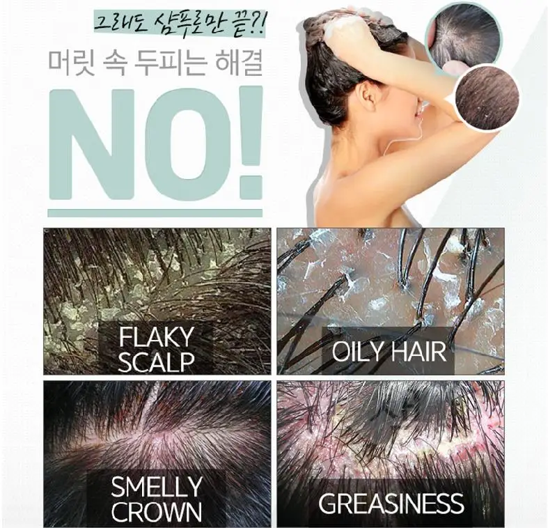 CP-1 для головы спа настойка для кожи головы 100 мл против выпадения волос лечение кожи головы Уход за волосами восстановление поврежденных кожного сала корейская косметика