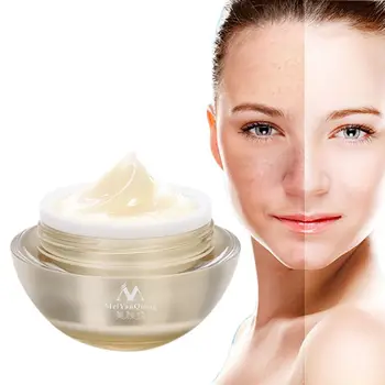 

New Medicated Pigment Medicated Whitening Cream Moisturizer Freckles care Freckle Chloasma Removal